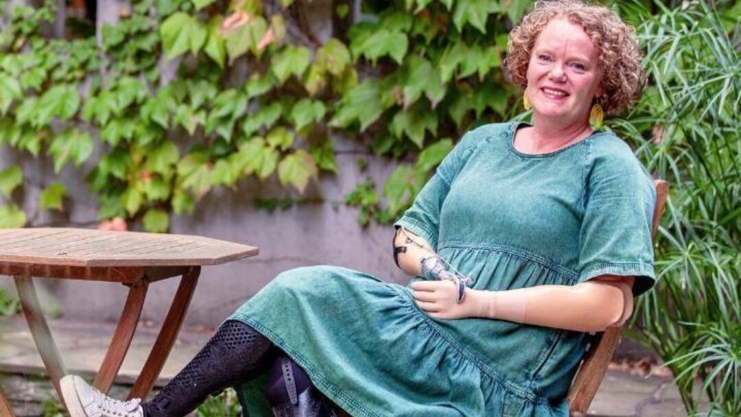 Mandy McCracken, seated, wearing prostethic arms